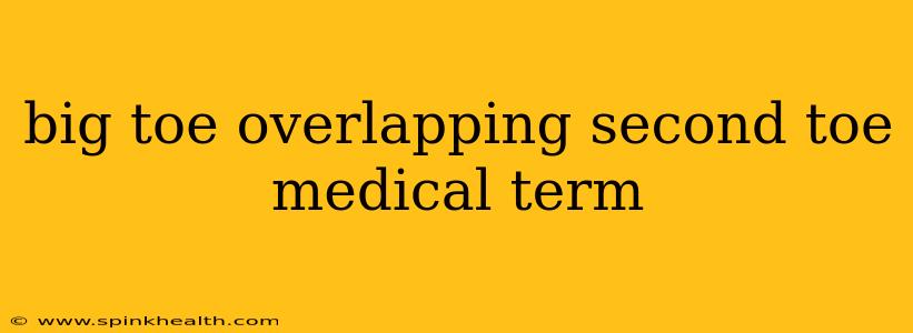 big toe overlapping second toe medical term