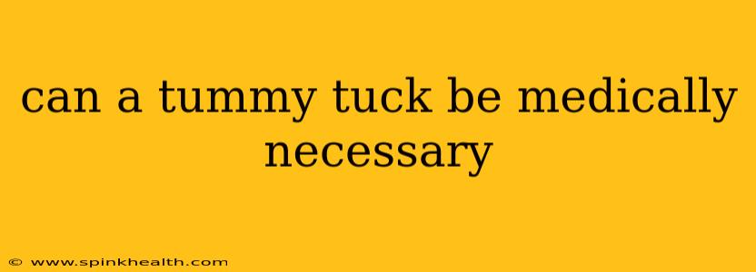 can a tummy tuck be medically necessary