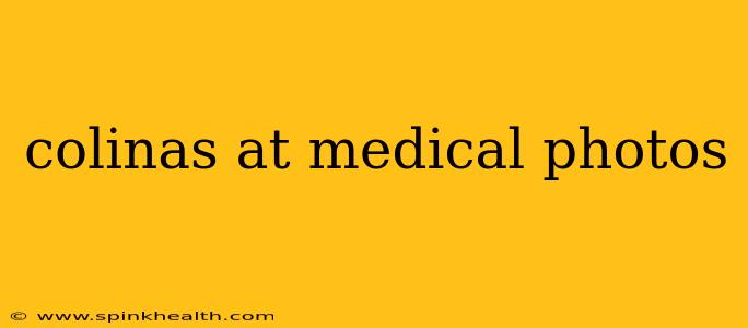 colinas at medical photos