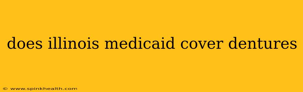 does illinois medicaid cover dentures