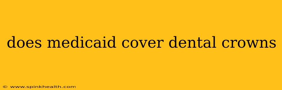 does medicaid cover dental crowns