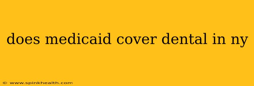 does medicaid cover dental in ny