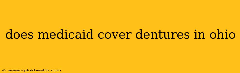 does medicaid cover dentures in ohio