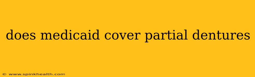 does medicaid cover partial dentures