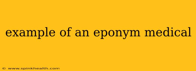example of an eponym medical
