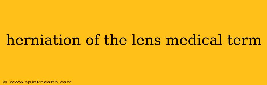 herniation of the lens medical term
