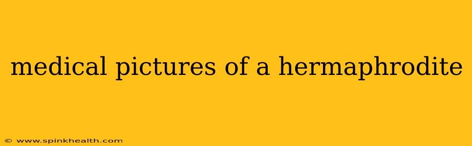 medical pictures of a hermaphrodite