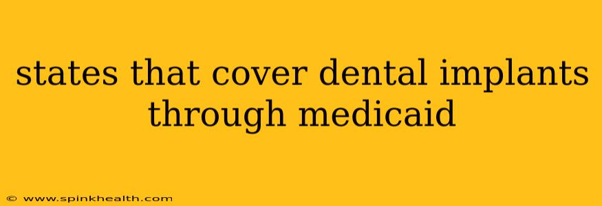 states that cover dental implants through medicaid