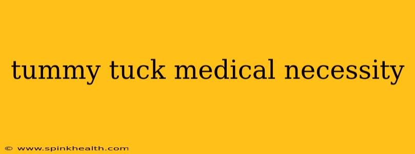 tummy tuck medical necessity