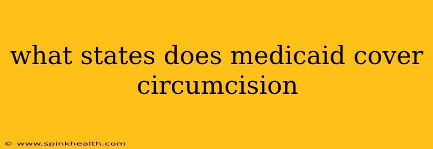 what states does medicaid cover circumcision