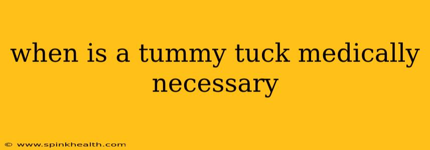 when is a tummy tuck medically necessary